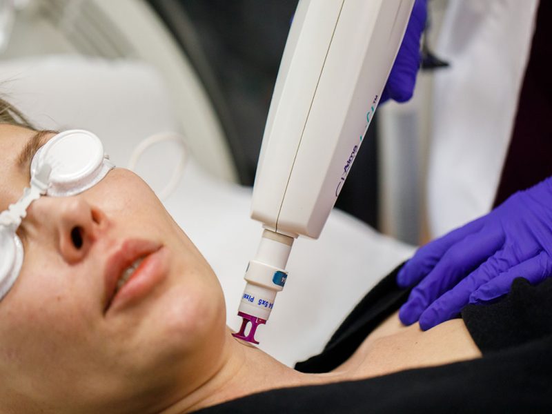 alma laser clearlift - skinmed clinic