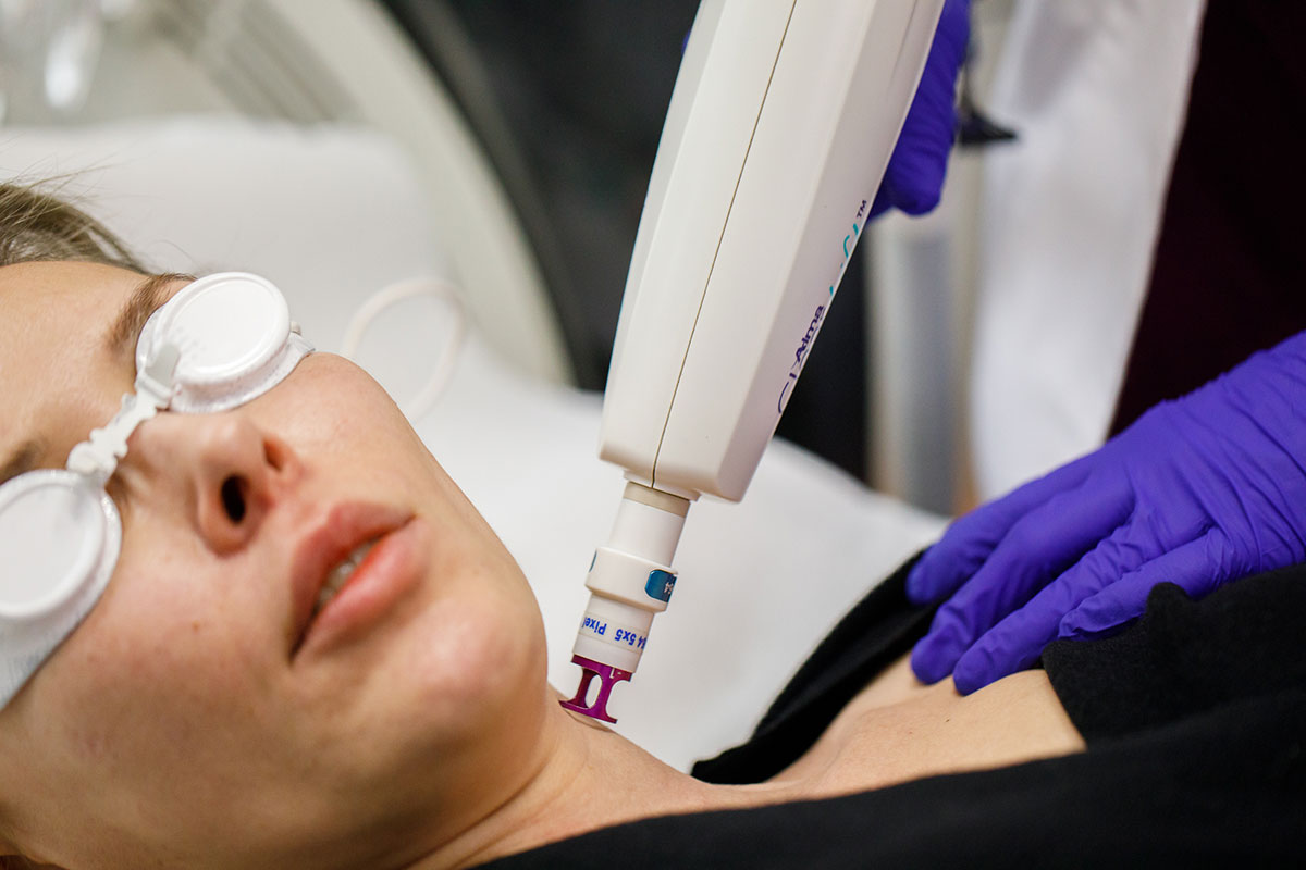 alma laser clearlift - skinmed clinic