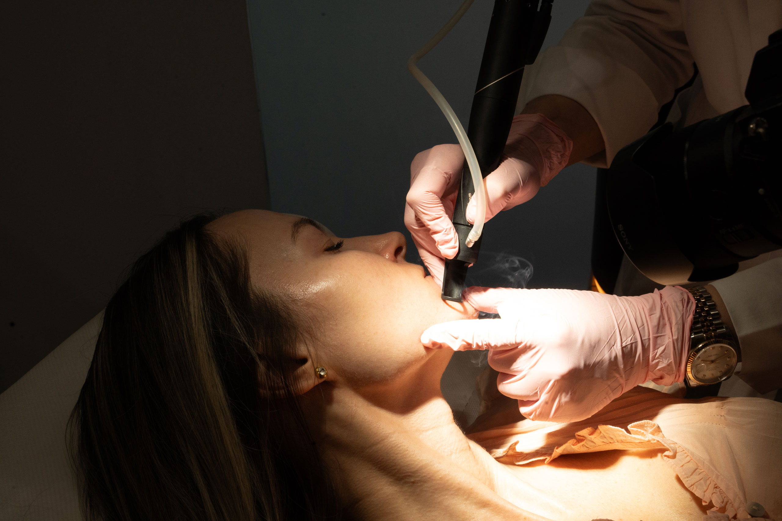 Laser sau injectabile pentru calitatea pielii?