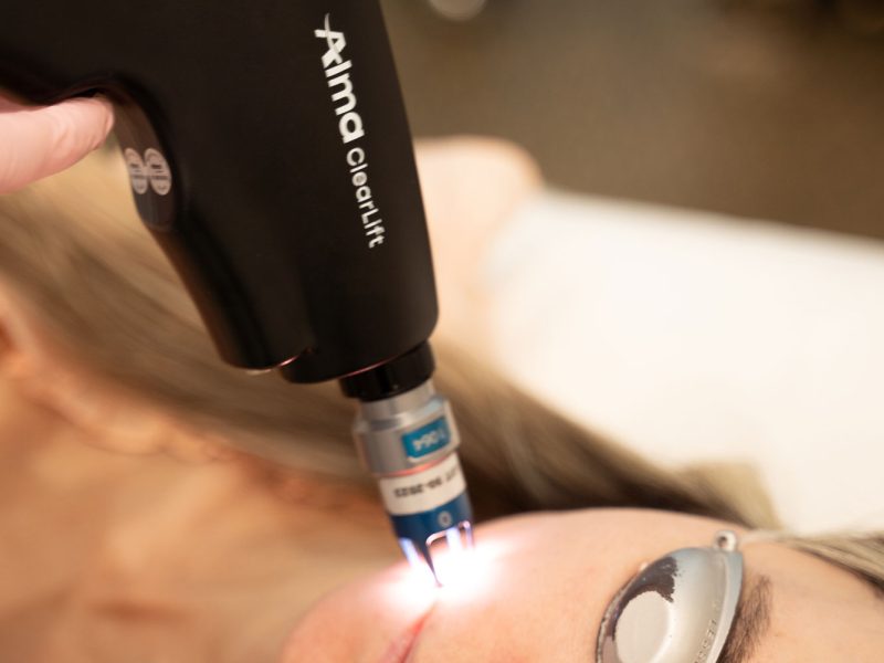 rejuvenare alma clearlift skinmed clinic
