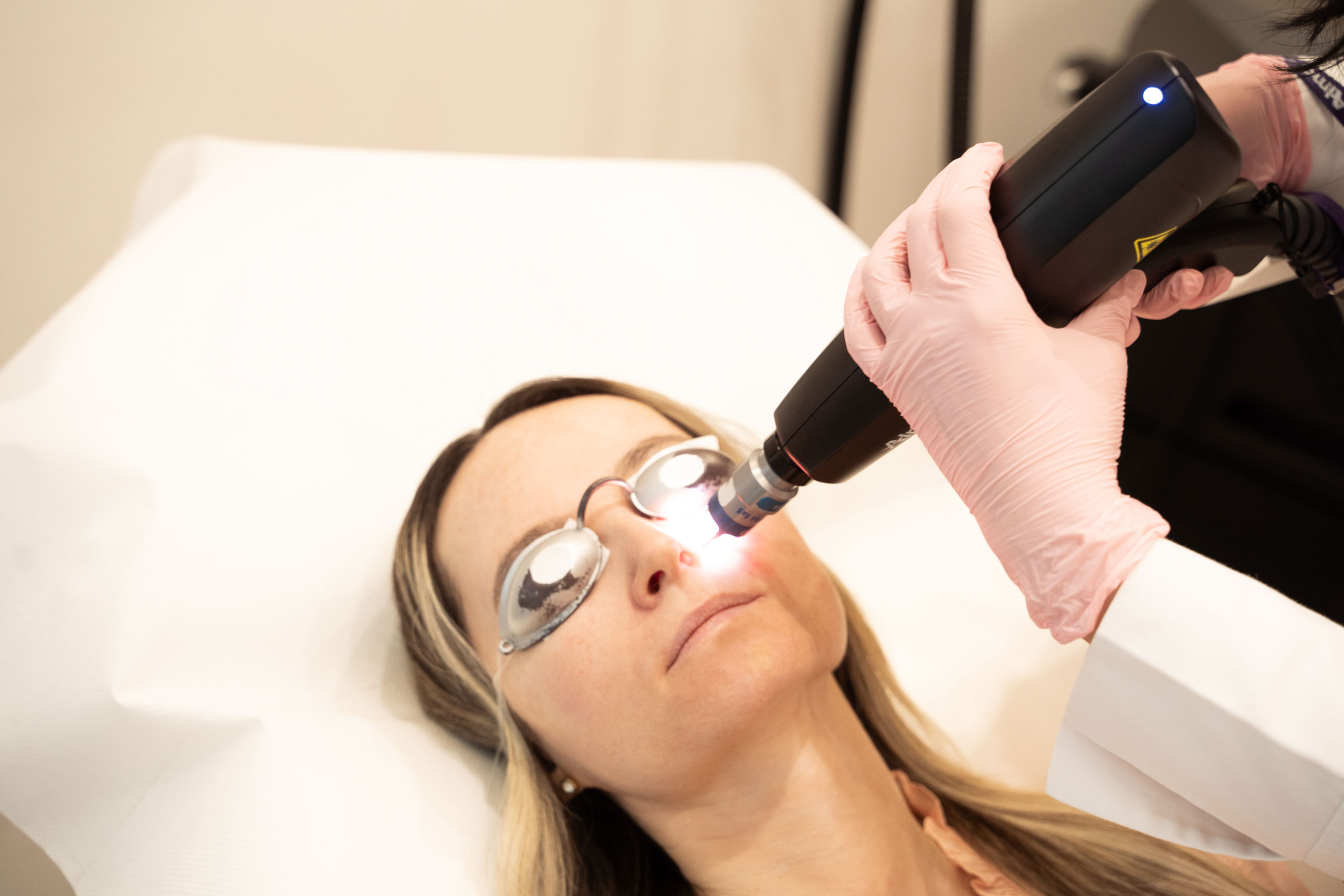 Tratamentele de toamnă care redau luminozitatea pielii – melasmă, pete pigmentare, rozacee și deshidratare