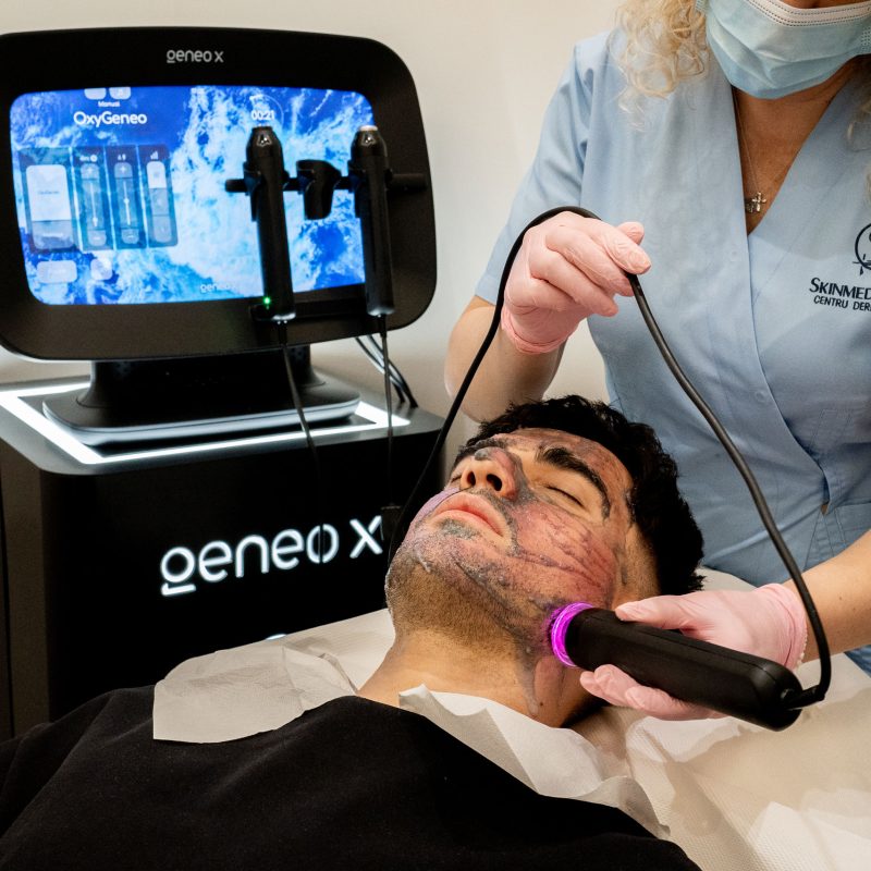 tratament acnee geneo x skinmed clinic