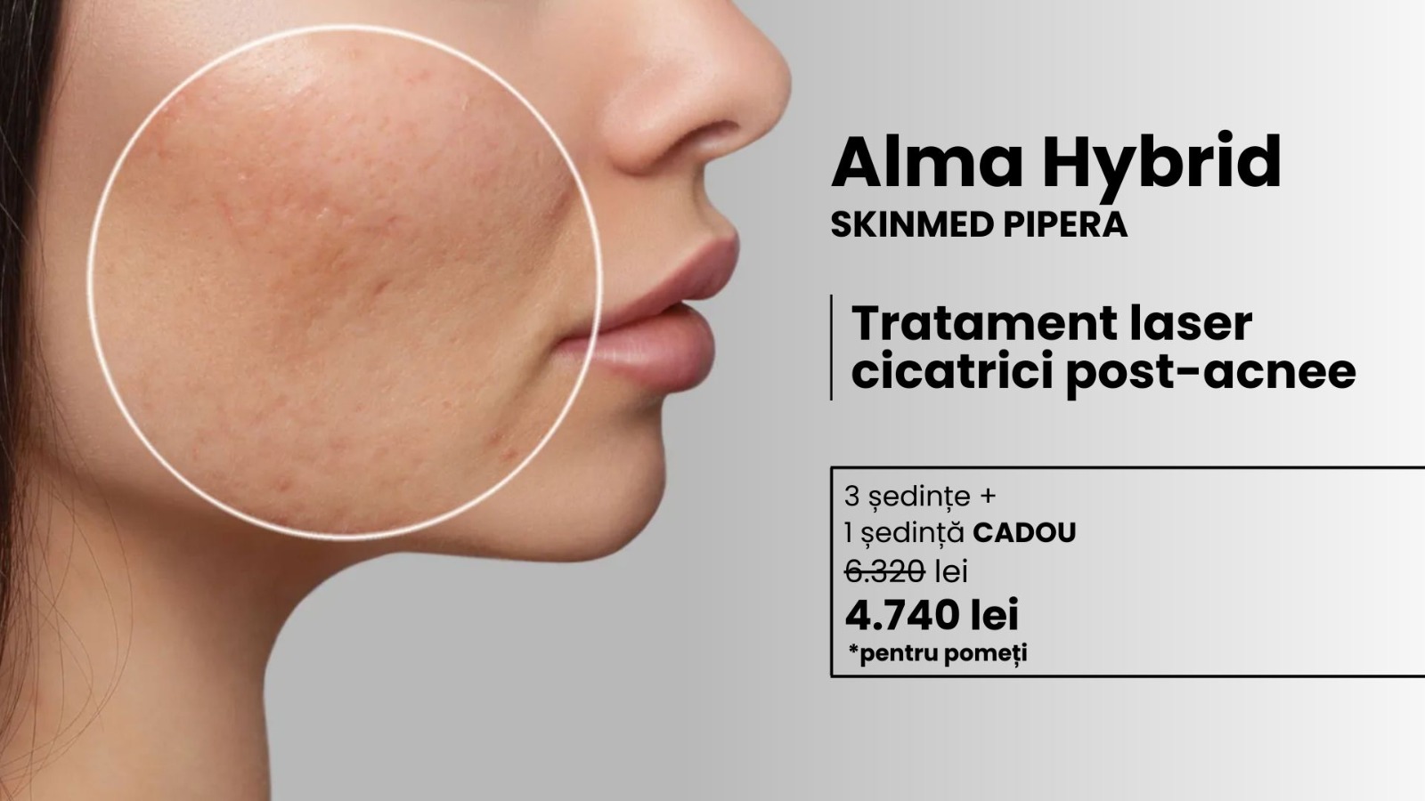oferta alma hybrid skinmed feb 26
