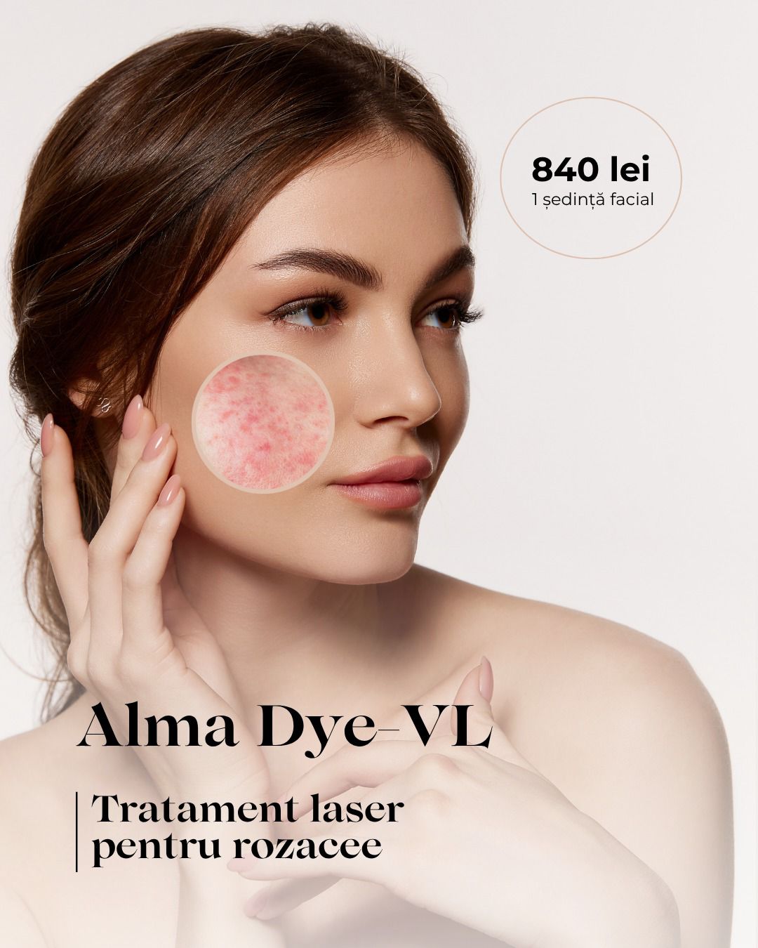oferta apr 2026 alma dye vl skinmed clinic mobil