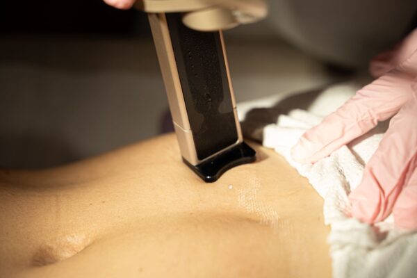 Alma Hybrid skinmed clinic 2026 03