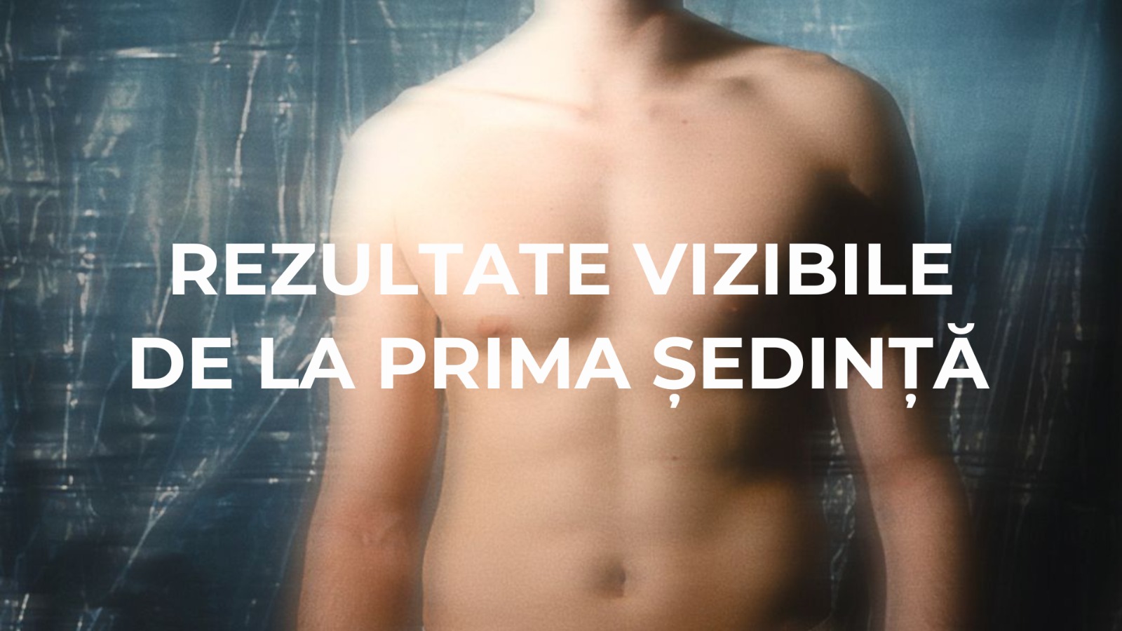 laser alma accent prime 2026 skinmed clinic