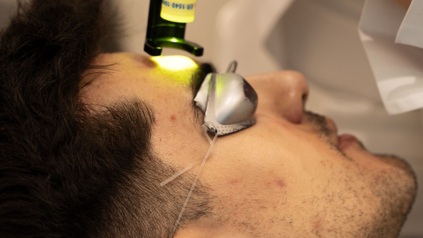 laser clearskin 2026 skinmed clinic