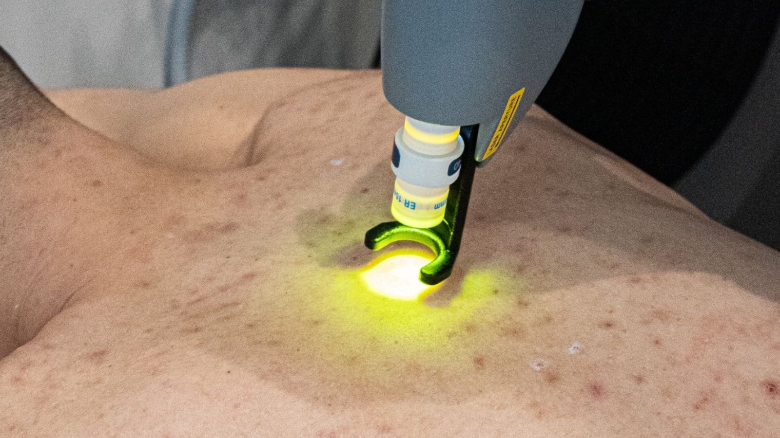 laser clearskin 2026 skinmed clinic
