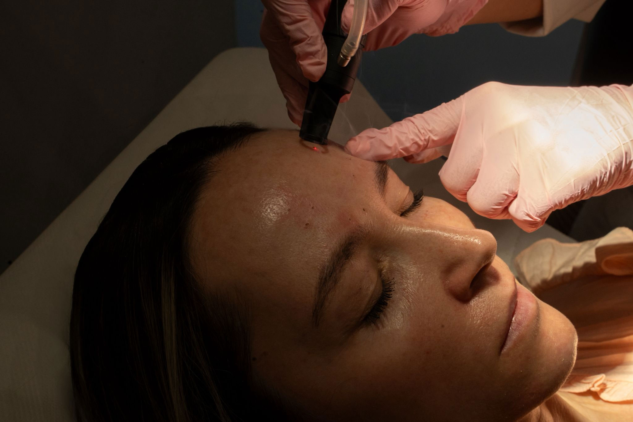 laser-co2-skinmed-clinic-2026-02