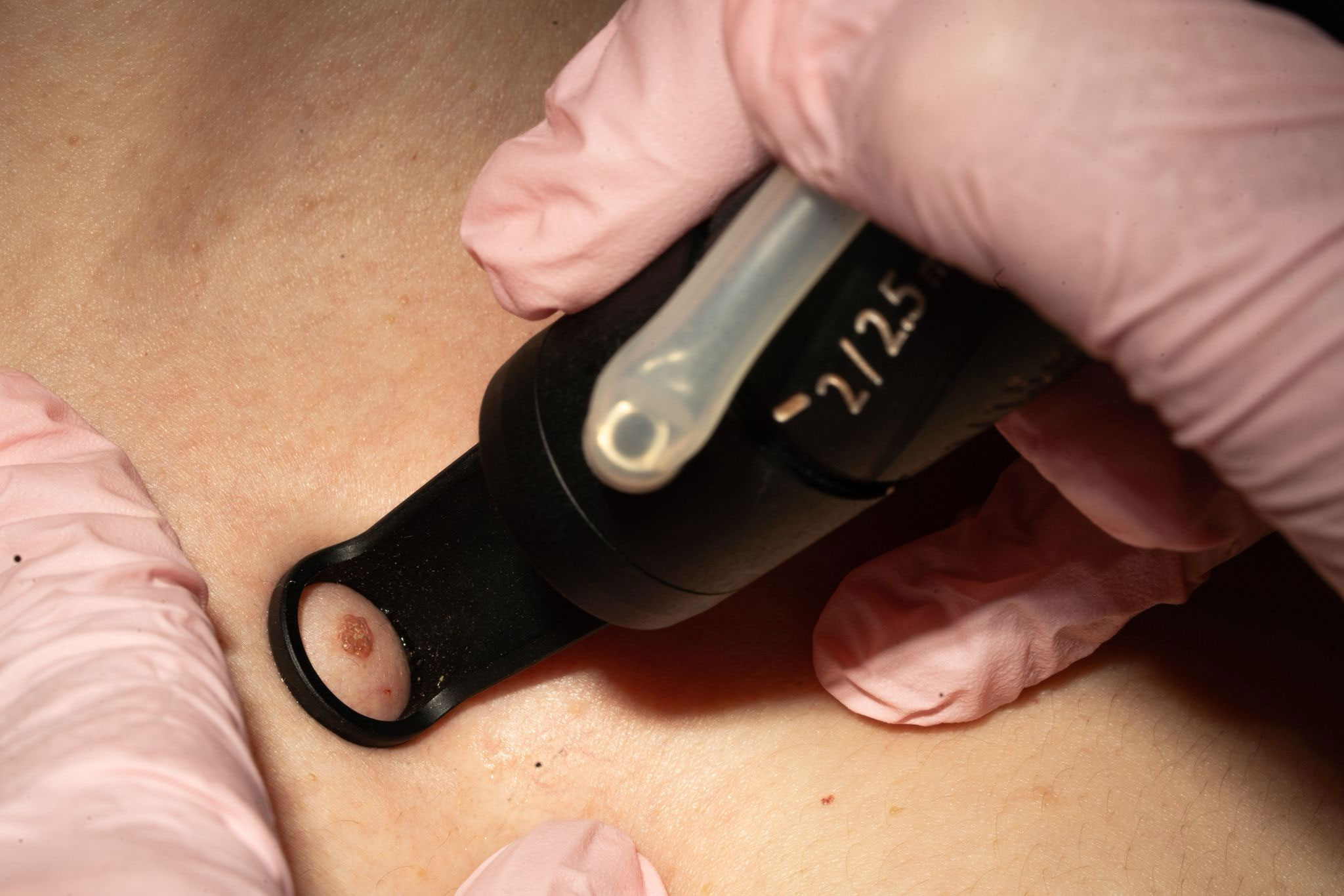 laser-co2-skinmed-clinic-2026-03