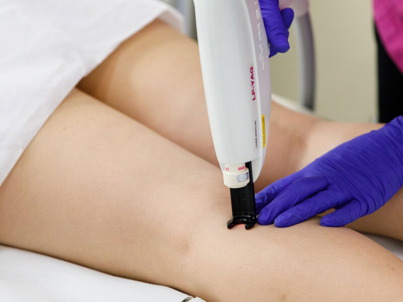 laser-ndyag-skinmed-clinic-2026